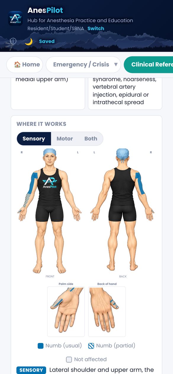 AnesPilot screen: Regional nerve blocks